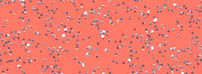Metal Flake Coral