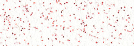 White Red